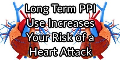Long Term PPI Use Increases Your Risk of a Heart Attack