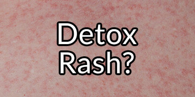 Detox Rash: Myth or Fact?