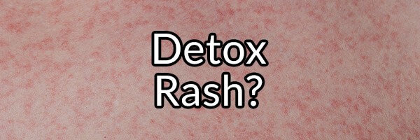 Detox Rash: Myth or Fact?