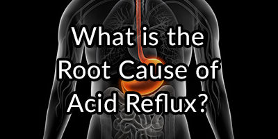 The GERD Enigma: What is the Root Cause of Acid Reflux?