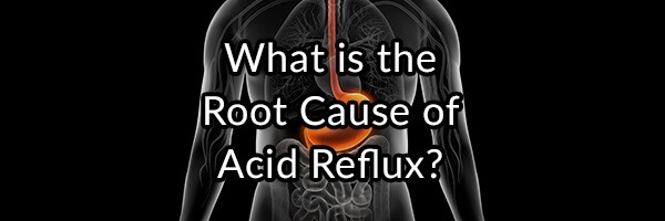 The GERD Enigma: What is the Root Cause of Acid Reflux?