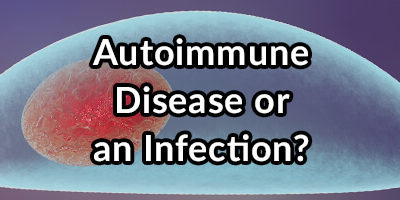 Do You Have an Autoimmune Disease or an Infection?