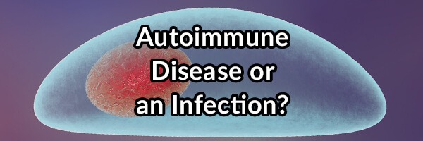 Do You Have an Autoimmune Disease or an Infection?