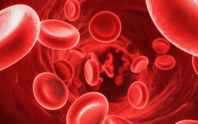 Why I Rarely Recommend Iron Supplements for Anemia